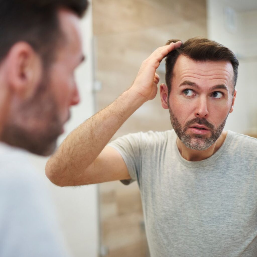 ¿La caída del cabello es hereditaria?