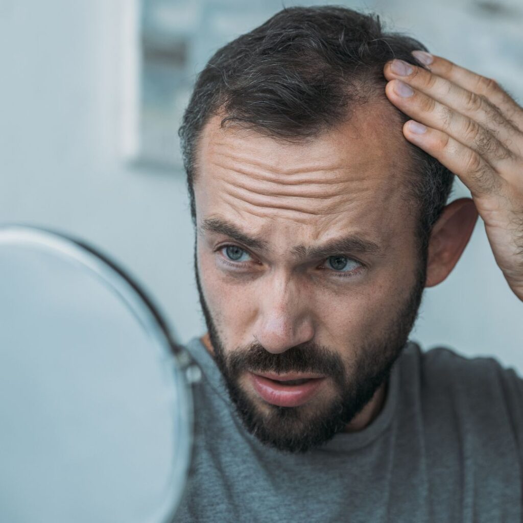 ¿La caída del cabello es hereditaria?